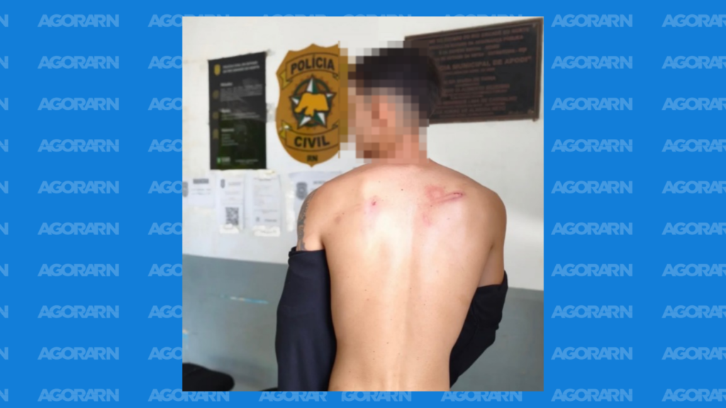 Estudante denuncia agressão de seguranças durante Carnaval em Apodi