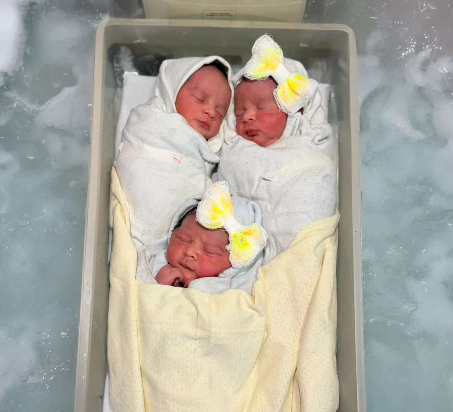 **Casal de Mossoró se surpreende ao descobrir trigêmeos só na hora do parto** **Casal de Mossoró se surpreende ao descobrir trigêmeos só na hora do parto**