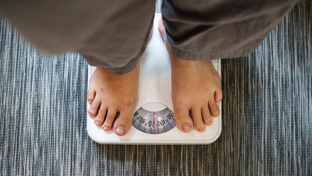 RN é o segundo estado com mais adultos obesos no Brasil