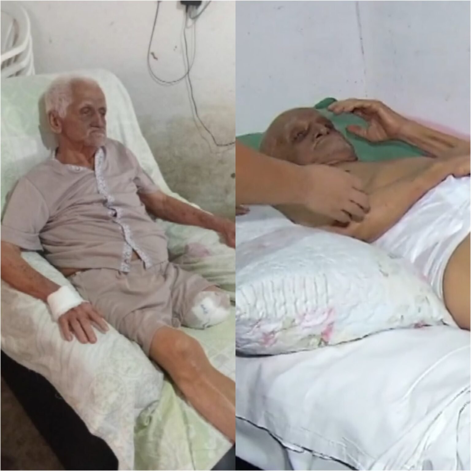 Fila de cirurgias no RN causa amputação de segunda perna em idoso