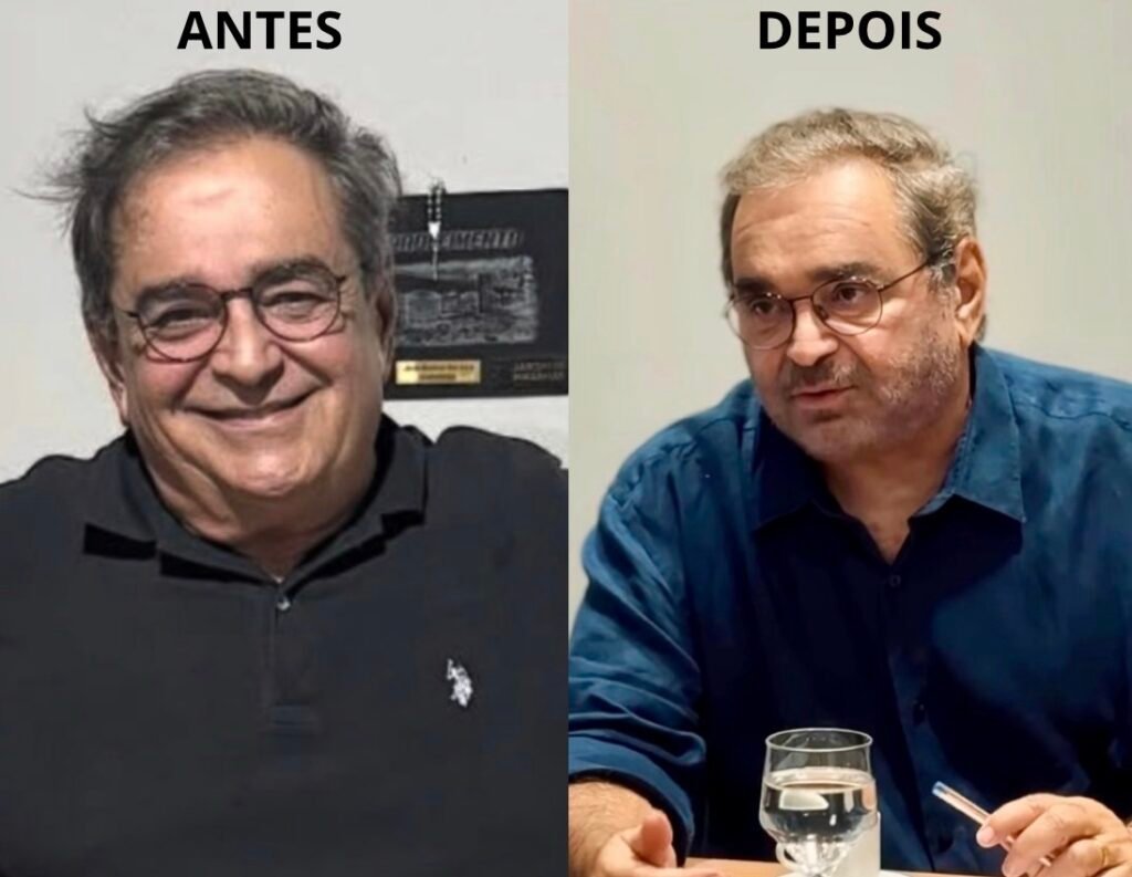 Álvaro Dias retorna com novo visual após cirurgia e procedimentos estéticos