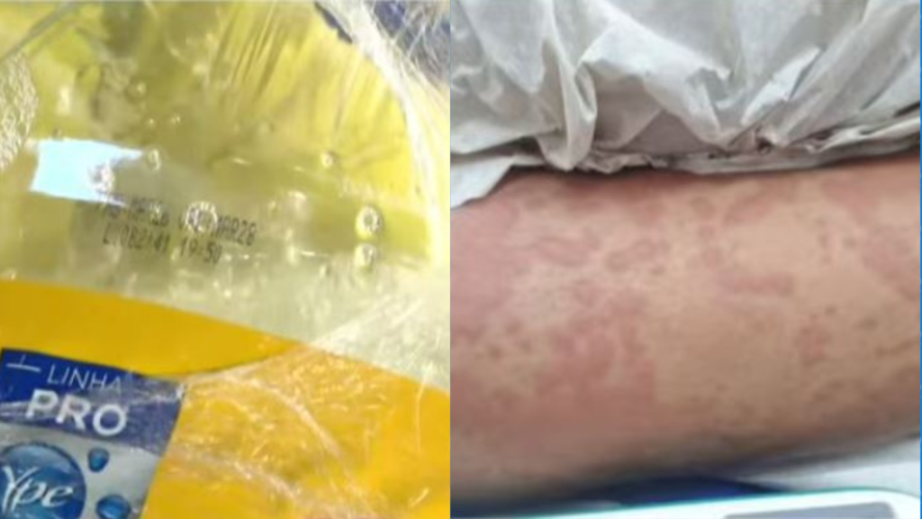 Criança é internada em Natal com suspeita de intoxicação por detergente