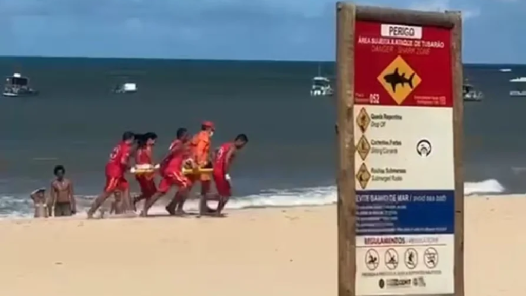 Criança perde perna após ataque de tubarão em praia de Pernambuco