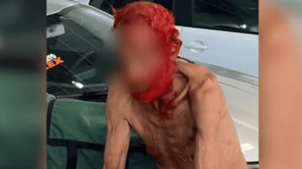 Polícia investiga empresário que pintou cabelo de idoso em situação de rua